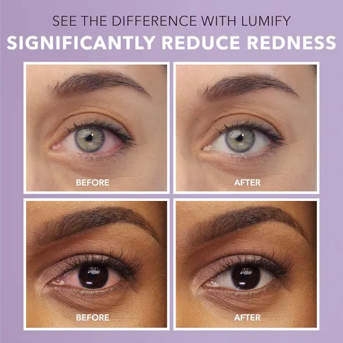 Vista 6 de LUMIFY Gotas para los ojos para aliviar el enrojecimiento de 0.17 onzas líquidas (0.2 fl oz) y gotas para los ojos aliviadoras del enrojecimiento