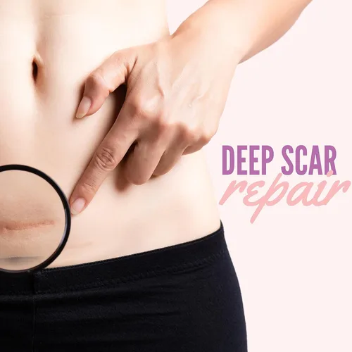 Vista 6 de Genovie MD Hojas de silicona para cicatrices de grado médico, tratamiento de rollo de cinta para cicatrices, queloides, acné, cirugías