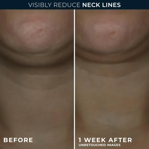 Vista 2 de RoC Derm Correxion Crema para el cuello con ácido hialurónico + Retinol avanzado para tensar y levantar visiblemente las líneas horizontales