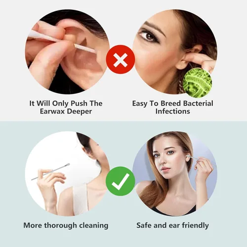 Vista 3 de Limpiador de cera de oídos, el maestro de limpieza de oídos más profesional en 2025: juego de herramientas de limpieza de cerumen, herramienta