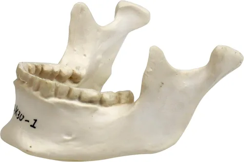Vista 2 de Parco Scientific PB00157 Cráneo de plástico totalmente desarticulado de 22 partes