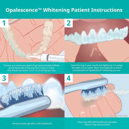 Vista 6 de Opalescence 35% CP Mint - Jeringas de gel para blanquear los dientes - Kit de recarga (4 jeringas) Gel de peróxido de carbamida. Fabricado por
