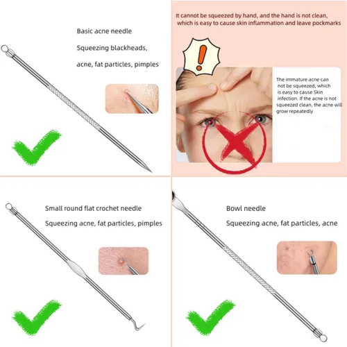 Vista 4 de Herramientas profesionales para eliminar puntos negros, kit de eliminación de acné extractor, herramienta para reventar espinillas, clip