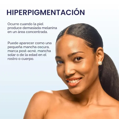 Vista 7 de Palmer's Skin Success - Loción corporal antimanchas antimanchas de leche, 8.5 onzas