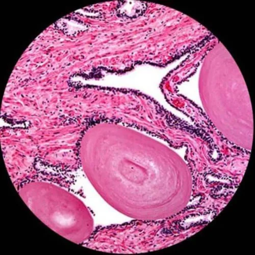 Vista 7 de AmScope Microscopio compuesto trinocular digital T360B-10M, aumento 40X-2000X, oculares WF10x y WF20x, Brightfield, iluminación LED, condensador