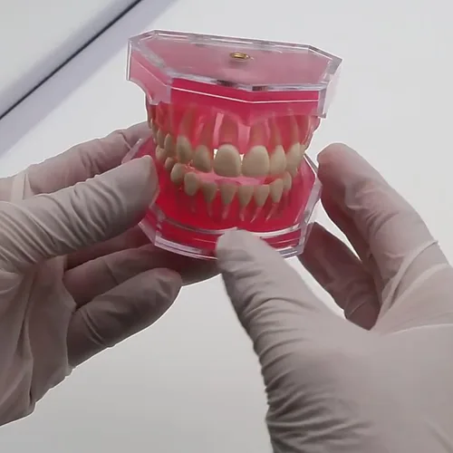 Vista 24 de Multifarious Tipos Modelo Dental Dientes Removibles Implante Ortodoncia Enseñanza Estudiar Modelos de demostración para Dentista Estudiante Escuela